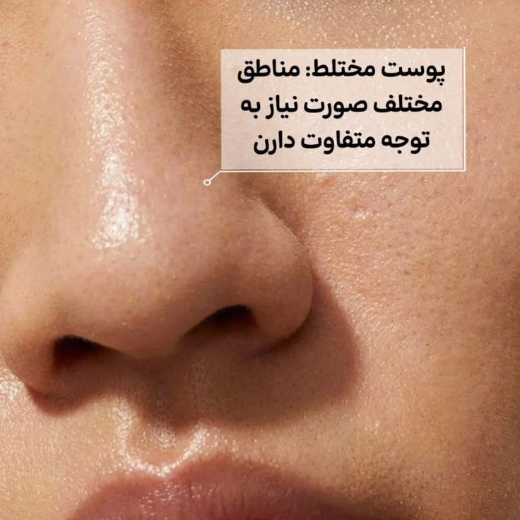 مراقبت از پوست مختلط