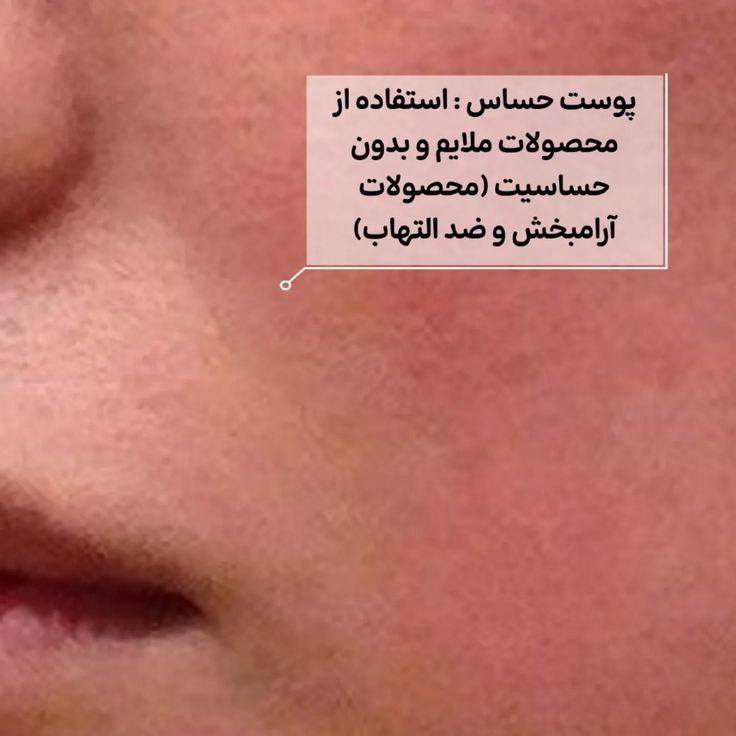 مراقبت از پوست حساس