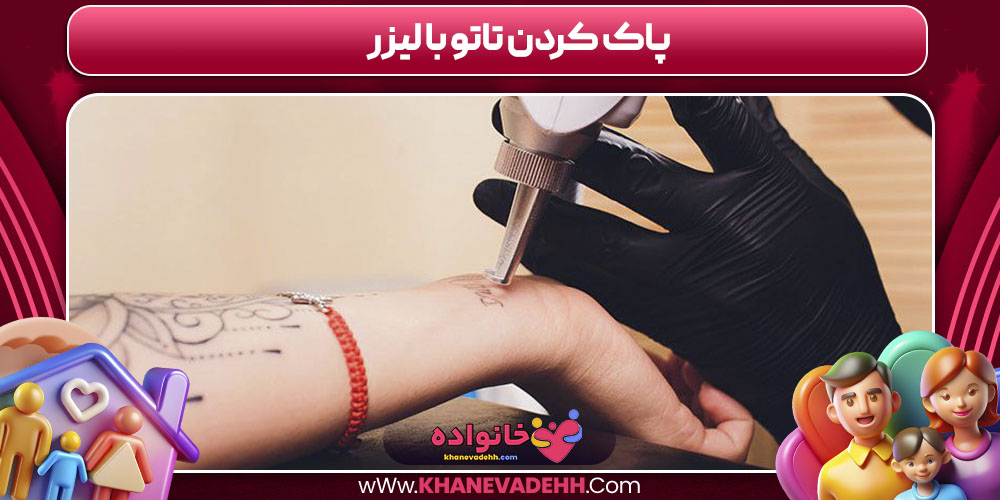 پاک کردن تاتو با لیزر