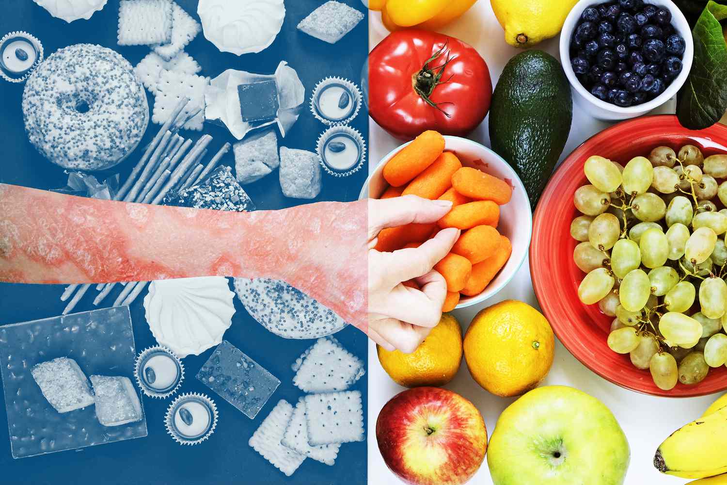 توصیه های تغذیه ای در پسوریازیس